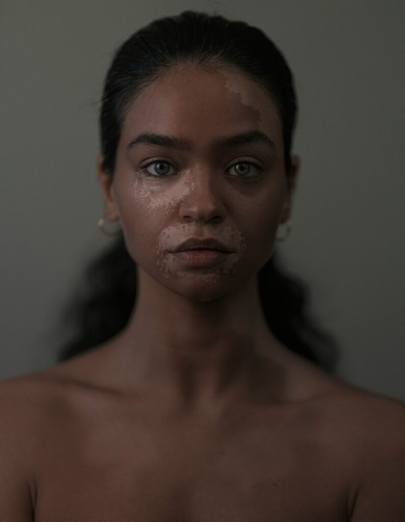 Schönheitsideal der Frau im Wandel. Frau ist unperfekt schön.