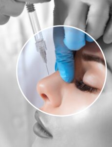 Frau erhält Hyaluron-Filler in die Nase als minimalinvasive Alternative zur klassischen Nasenkorrektur